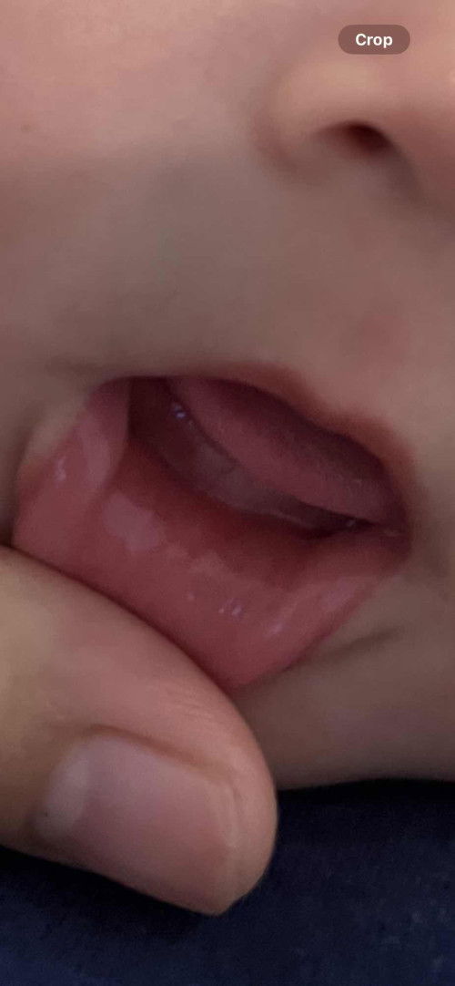 Teething na po ba ito?