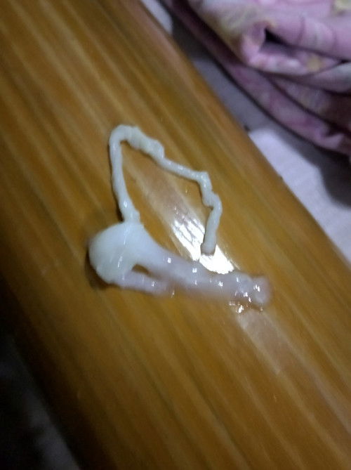 Normal lang poba ganito kadaming discharge?