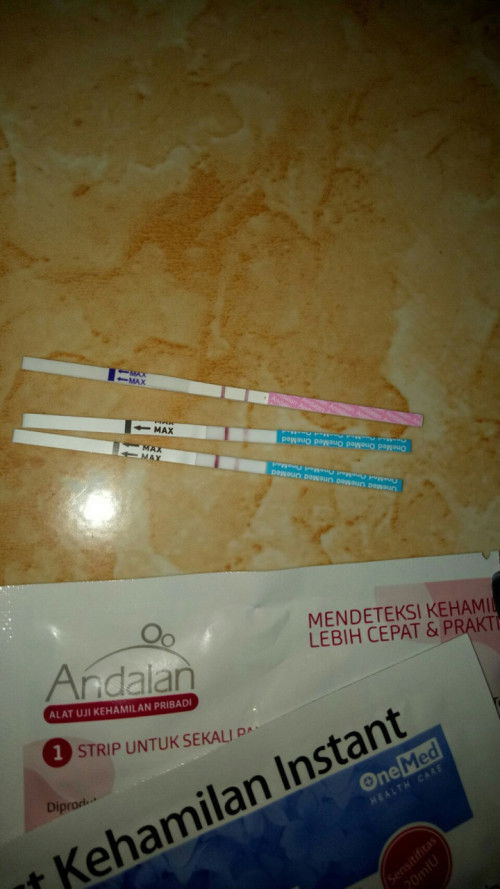 kebobolan KB IUD