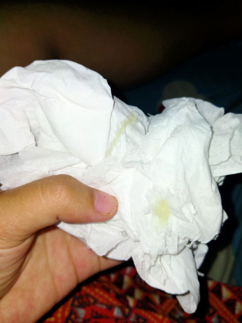 Keluar lendir putih di kehamilan 38 Minggu