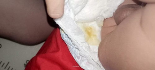 Kalo pup bayi gini normal g ya