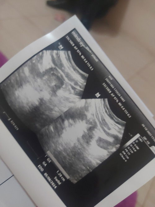 Makin pesimis bakal BO lgi 😭😭