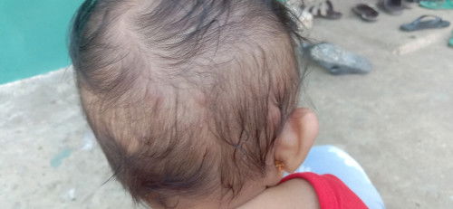 Bintik bintik nanah di kepala seperti bisul