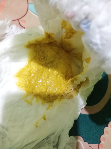 Bayiku usia mau 3bln dia alergi susu sapi jadi ganfi susu soya, normal bab gmn & brp kali sehari yah