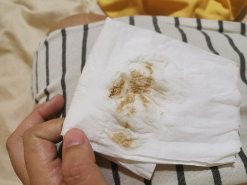 38วีค3วันมีอาการปวดท้องแล้วมีเหมือนเลือดเลอะทิชชูค่ะ