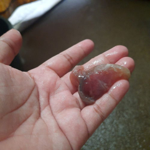 Mucus plug @ 38 weeks