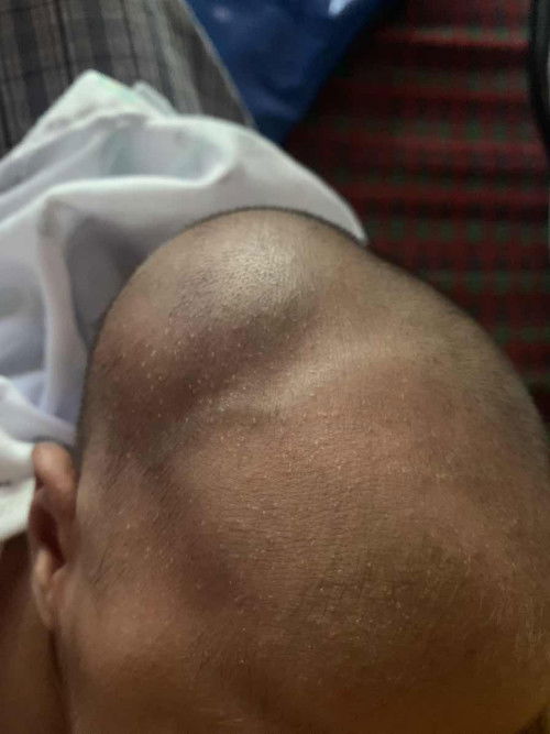 ลูกหัวปูดแรกคลอด