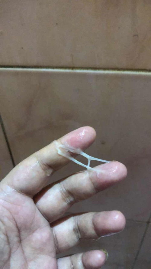 keluar lendir putih saat 36minggu 3 hari