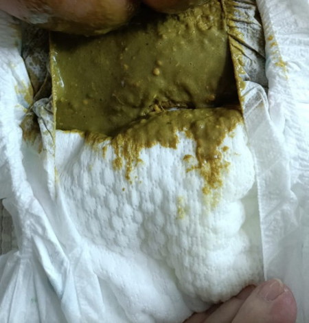 Hi, need help , is this diarrhea? 1mth plus baby, fully formula milk