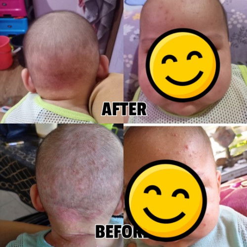 Sebelum dan selepas 😊