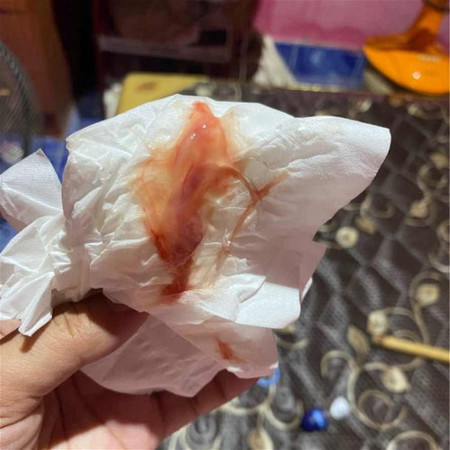 39+4มีแต่มูกเลือด