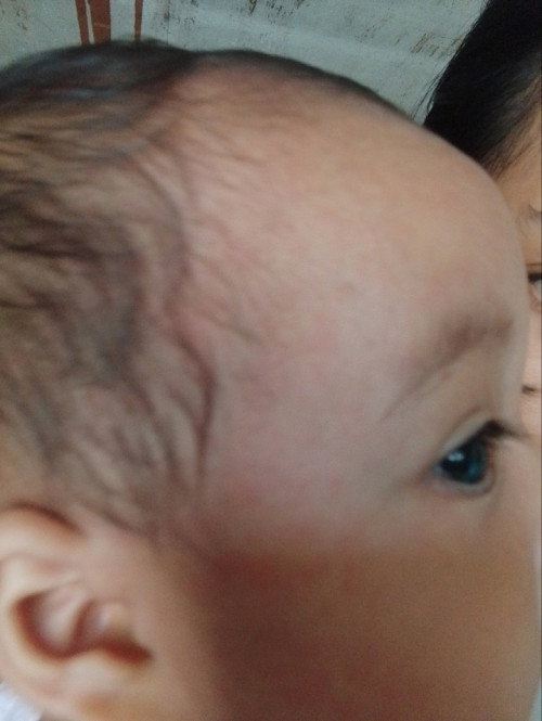 Bayi 6 bulan Kerumutan