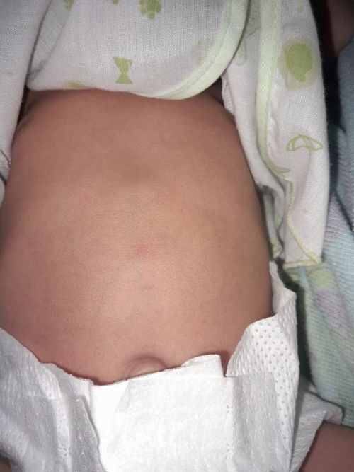 ลูกหายใจแล้วหน้าอกบุ๋มนิดหน่อยปกติไหมคะ