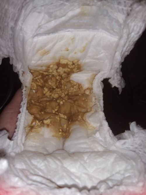 Baby saya 5bln minum susu dutch baby, hari ni tiba2 berak cair tapi subuh tdi berak ok..