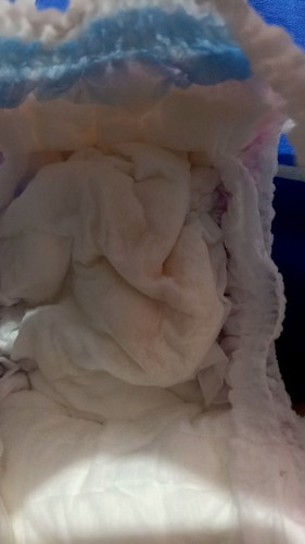 ลูก6เดือนฉี่แล้วมีเลือดปนออกมาเป็นอะไรมั้ยคะ