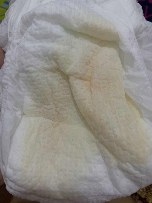 kencing bayi 6,5 bulan