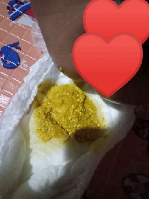 Bayi 1 bulan pup seperti diare