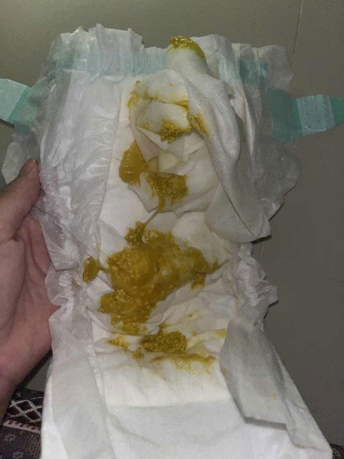 อึแบบนี้ปกติมั้ยคะ