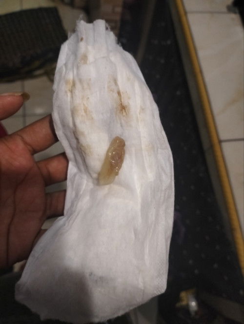 Mw naya mom ada yg pernah ngerasain keluar gumpalan kaya sya gk.