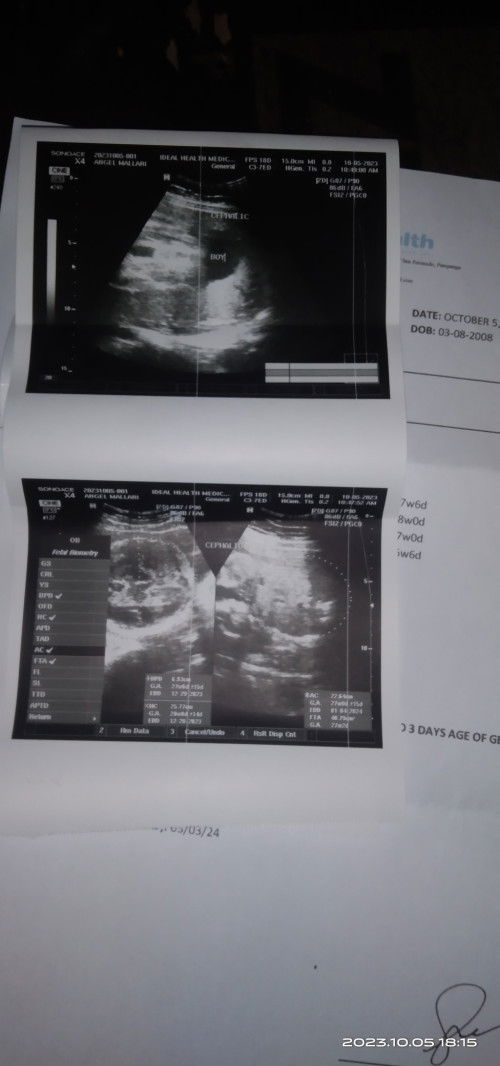 Ask kolang po kung Ilan months na poba ang 27 weeks and 3 days kàse po ng pa ultrasound po ako