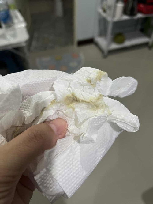 แบบนี้คืออะไร ท้อง36วีคคะ