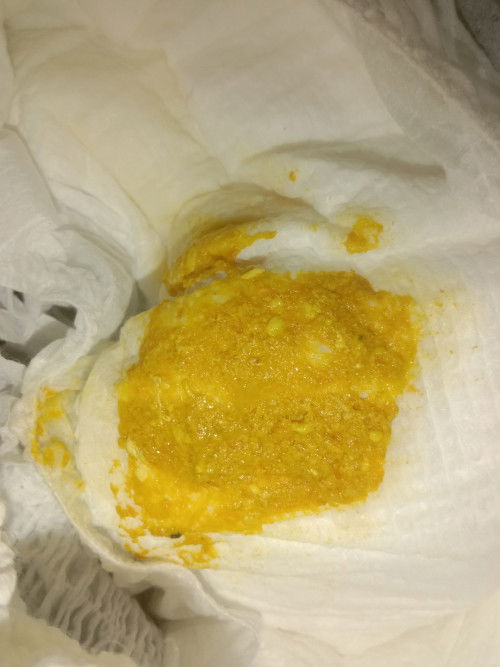 ขอสอบถามค่ะเเม่ๆ