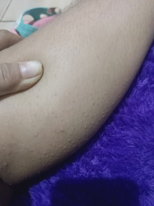 Gatal saat usia kehamilan 37week