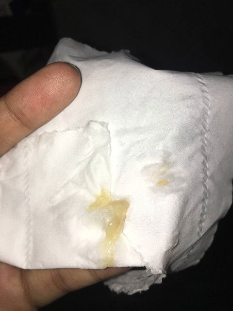 Ano po kaya ibig sabihin neto? Parang jellow, walang amoy. 36wks pregnant, 1cm nung na i.e. Thanks.