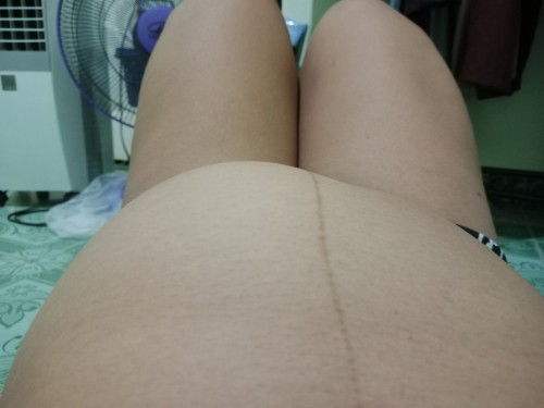 ท้องแข็งบ่อย  31 W