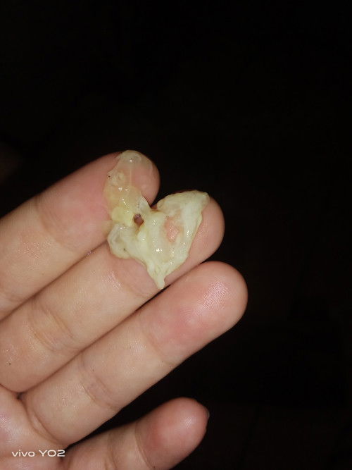 ท้องได้39สัปดาห์5วันแล้ว