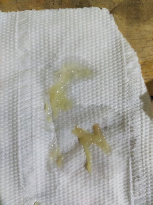 ขอความรู้หน่อยคะแม่ๆ