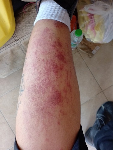 มีแม่ๆท่านไหนเป็นแบบนี้บ้างคะ