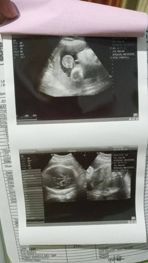 Hpl beda jauh di buku 17 pktober di usg 06 oktober