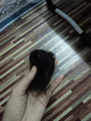 Rambut gugur teruk