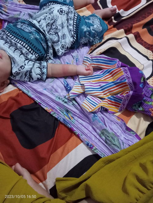 Biduran bayi 6 bulan