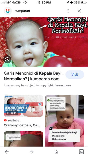 Garis menonjol dekat kepala bayi