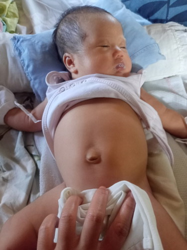 natural lang po ba na qanito ang tiyan ng baby
