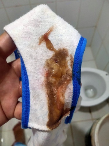 Lumalabas na dugo