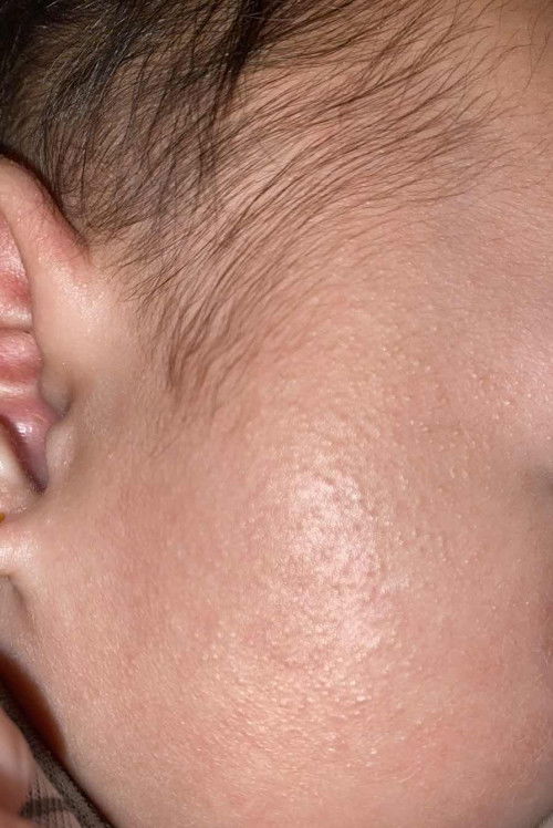 Alergi susu sapi kah ini?