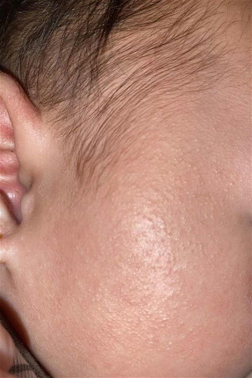 Alergi susu sapi kah ini?