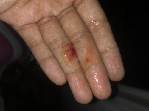Hamil 38 minggu