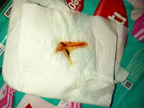 Flek diusia kehamilan 25 minggu.