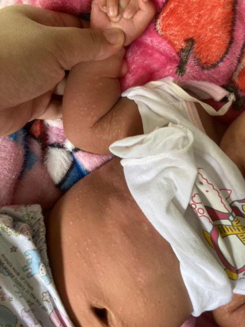 แม่ๆเคยเจอแบบนี้มั้ยคะ?