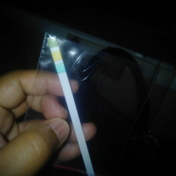 Hasil cek urin tidak tau artinya