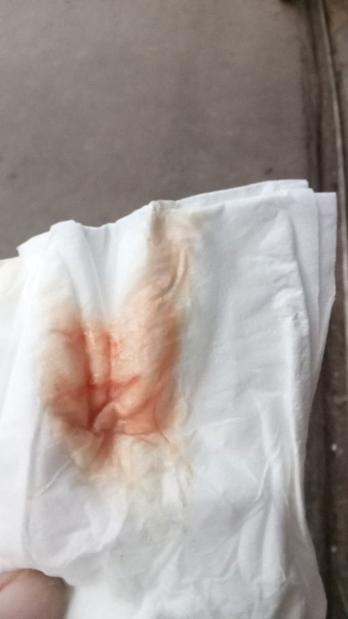 Keluar darah di usia 38week