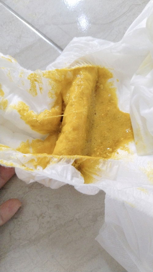 Ada yang tau ini diare apa normal