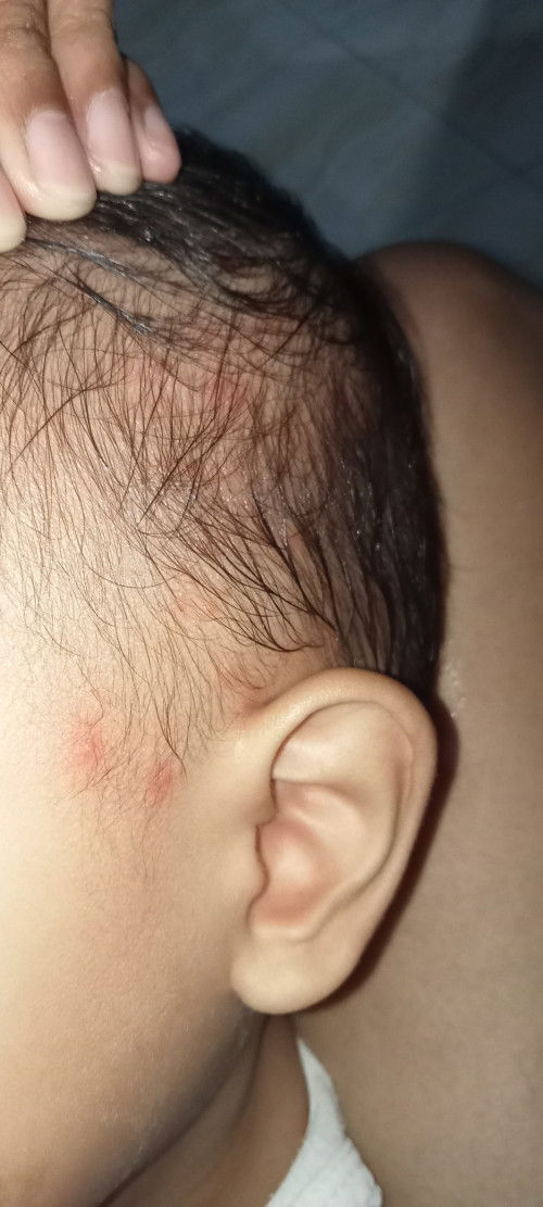 Bintik merah dikepala