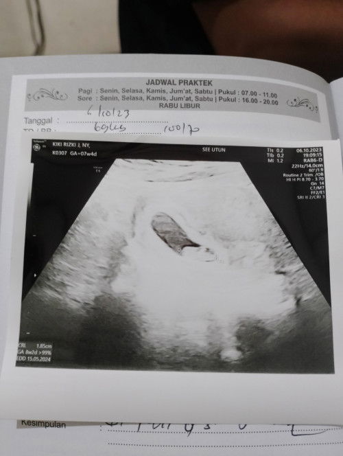 Perkiraan 7w tpi usg 8w