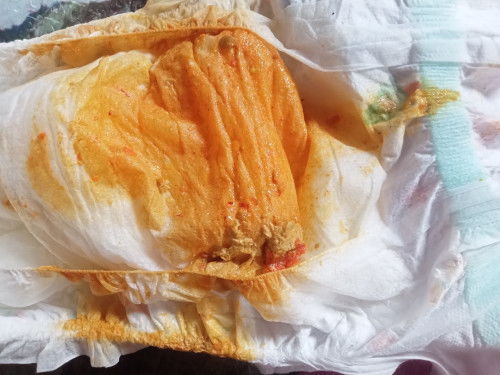 เลือดหรือแตงโม