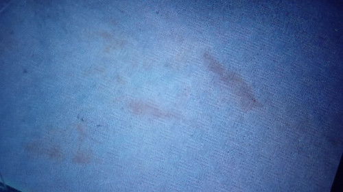 Hamil usia 9 minggu keluar flek